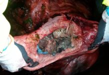 Whale Found Off The West Coast of Norway With 30 Plastic Bags In Its Stomach